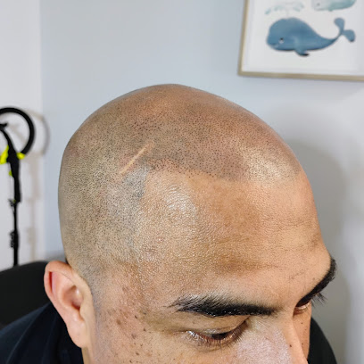 Inked Illusions - Scalp Micropigmentation (SMP Hair Tattoo), Calgary